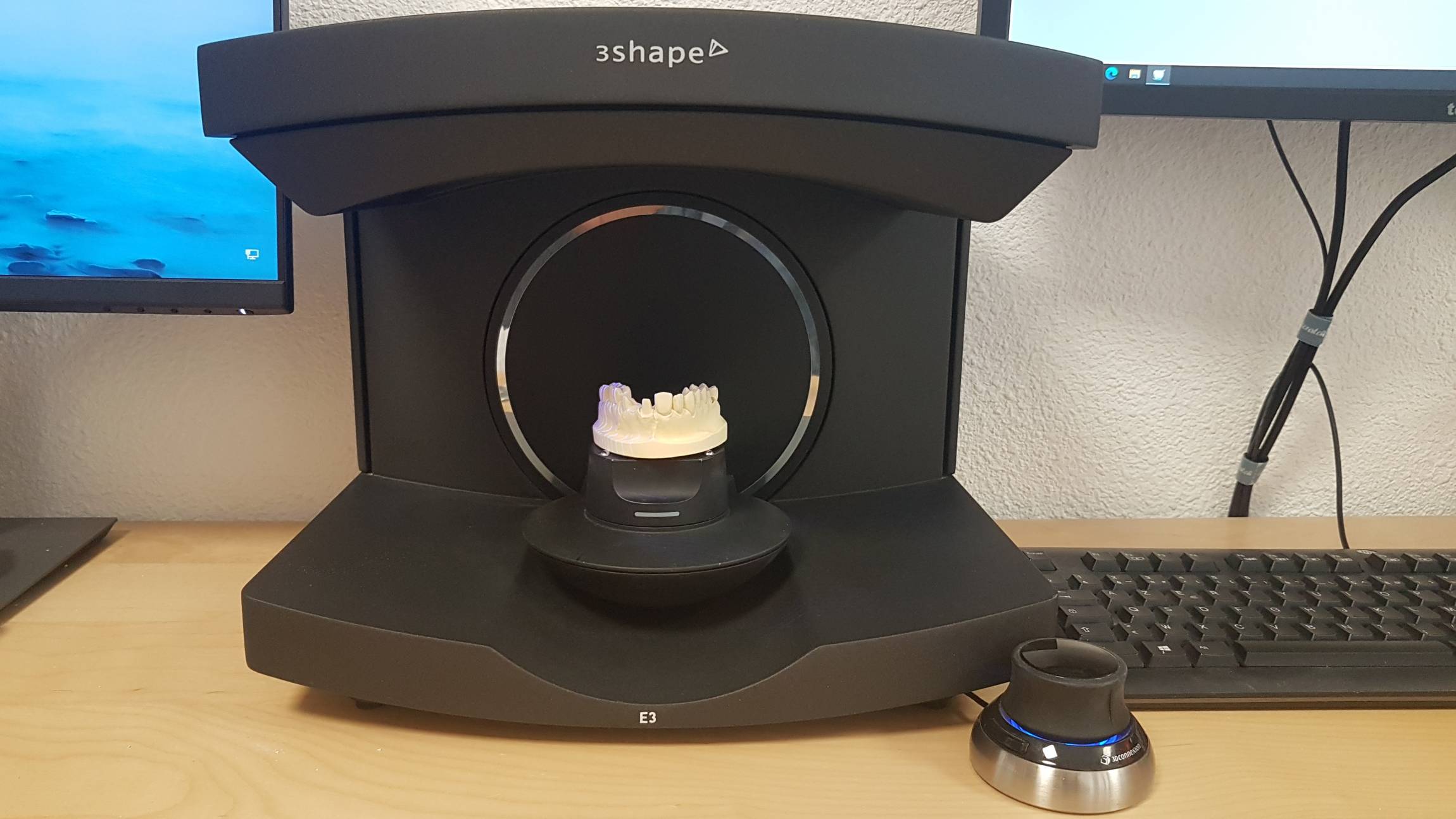 Scanner 3Shape — numérisation des empreintes dentaires